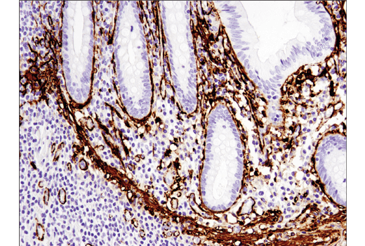  Image 25: Cancer Associated Fibroblast Marker Antibody Sampler Kit