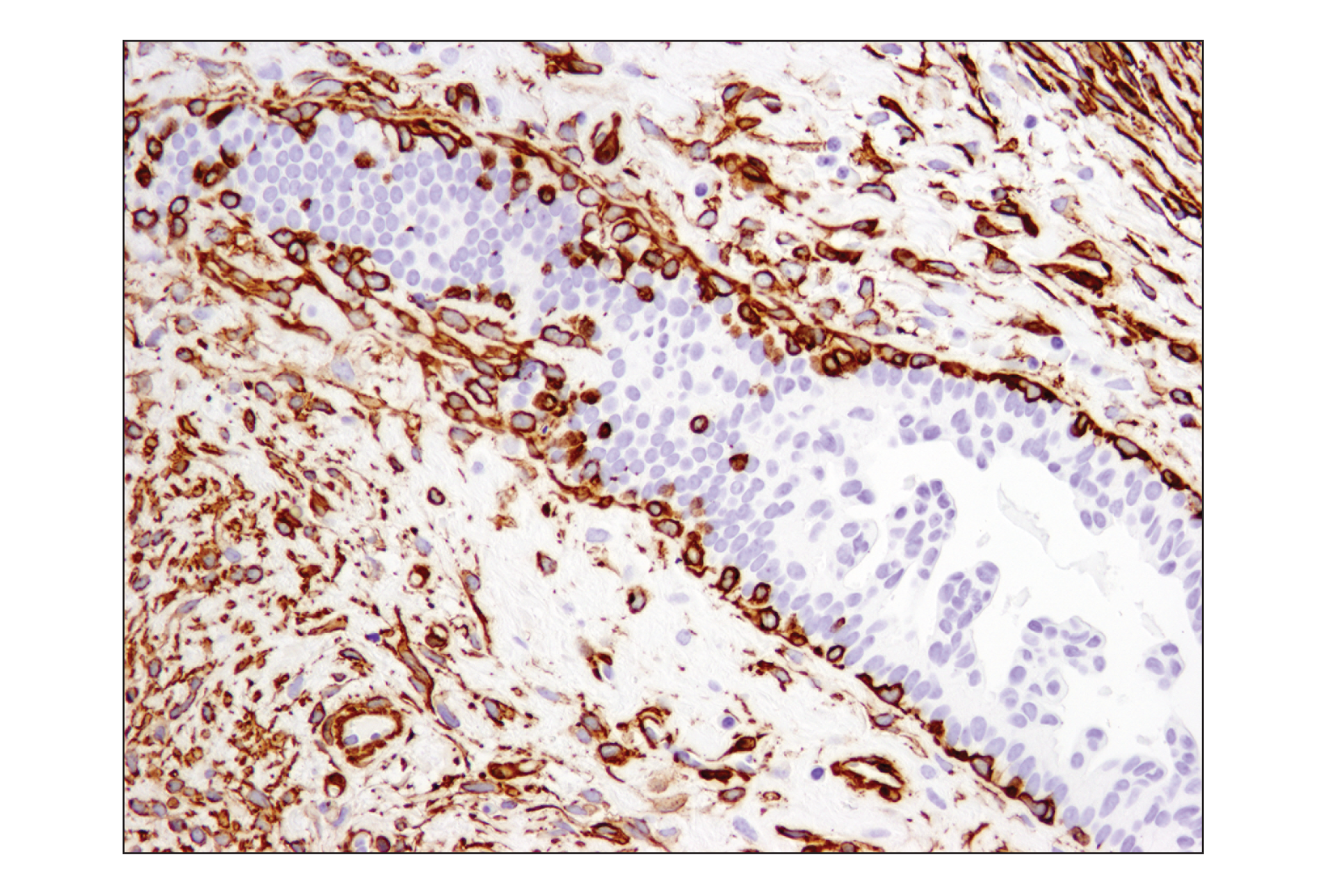  Image 27: Cancer Associated Fibroblast Marker Antibody Sampler Kit