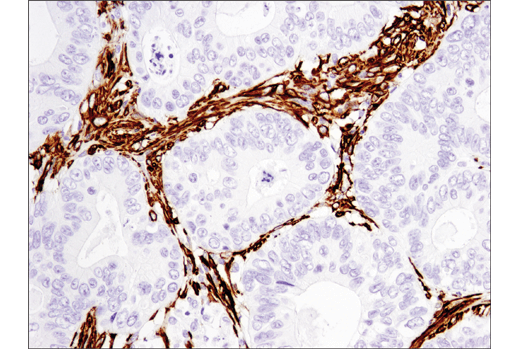  Image 31: TGF-β Fibrosis Pathway Antibody Sampler Kit