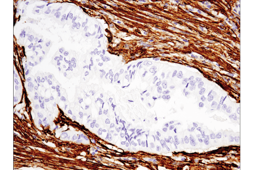  Image 33: Cancer Associated Fibroblast Marker Antibody Sampler Kit