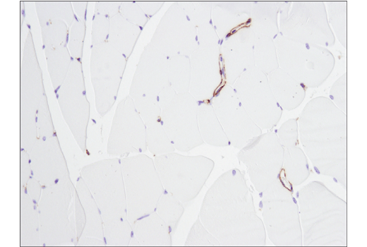  Image 38: Cancer Associated Fibroblast Marker Antibody Sampler Kit