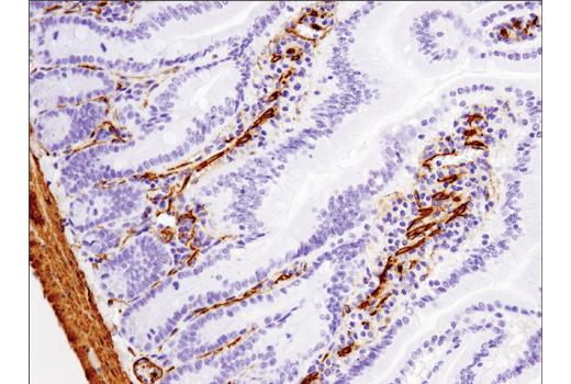  Image 40: Cancer Associated Fibroblast Marker Antibody Sampler Kit