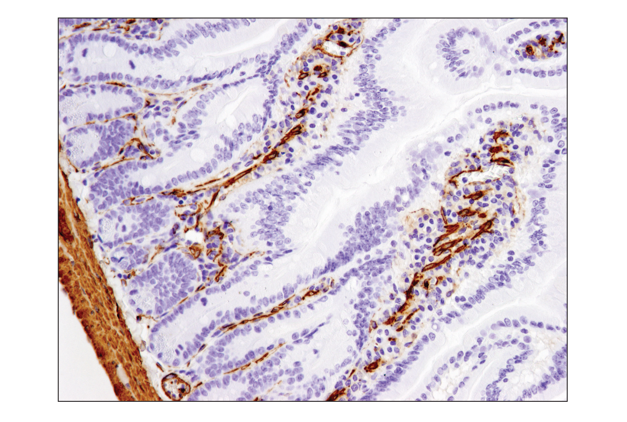  Image 44: Cancer Associated Fibroblast Marker Antibody Sampler Kit