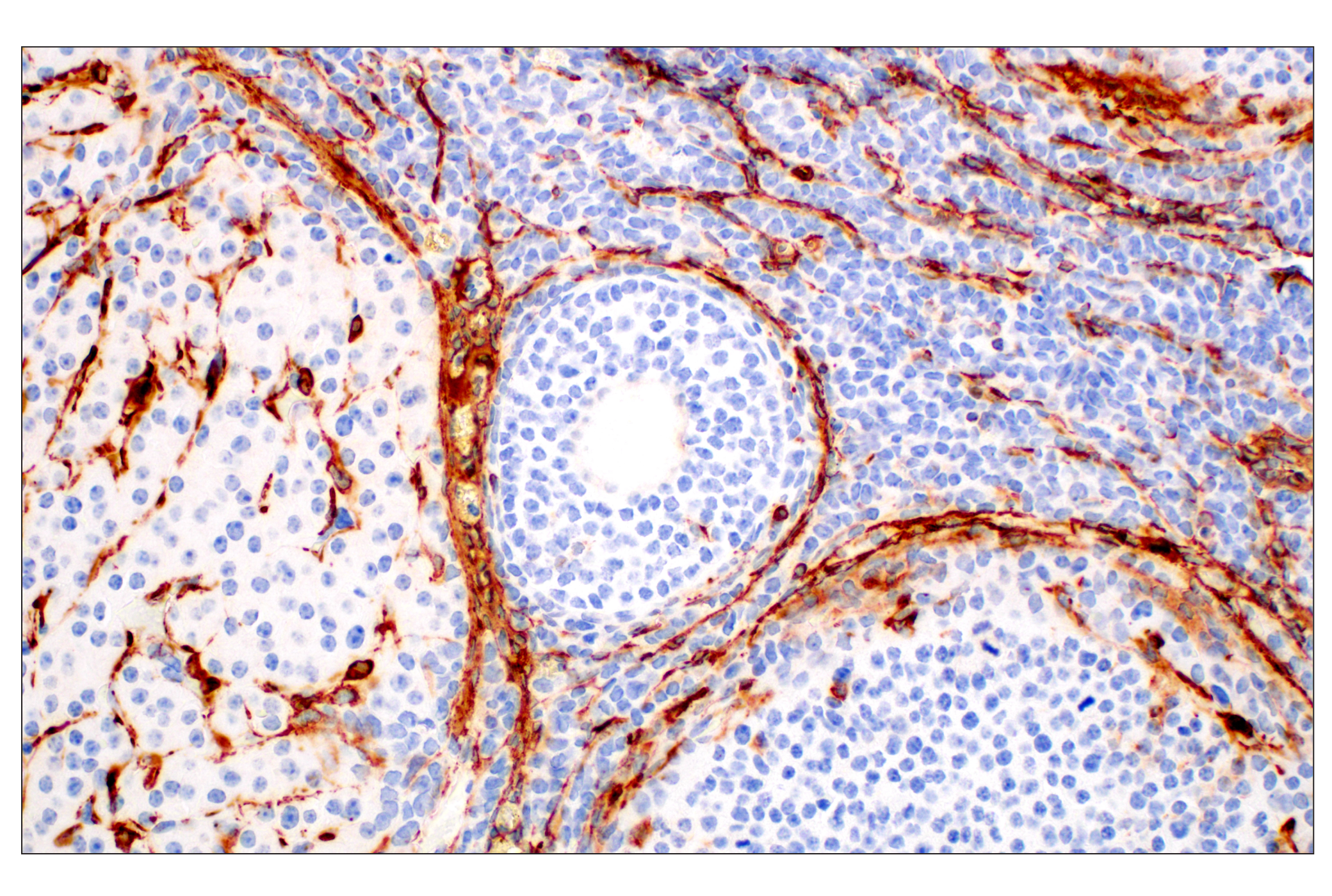  Image 58: Cancer Associated Fibroblast Marker Antibody Sampler Kit