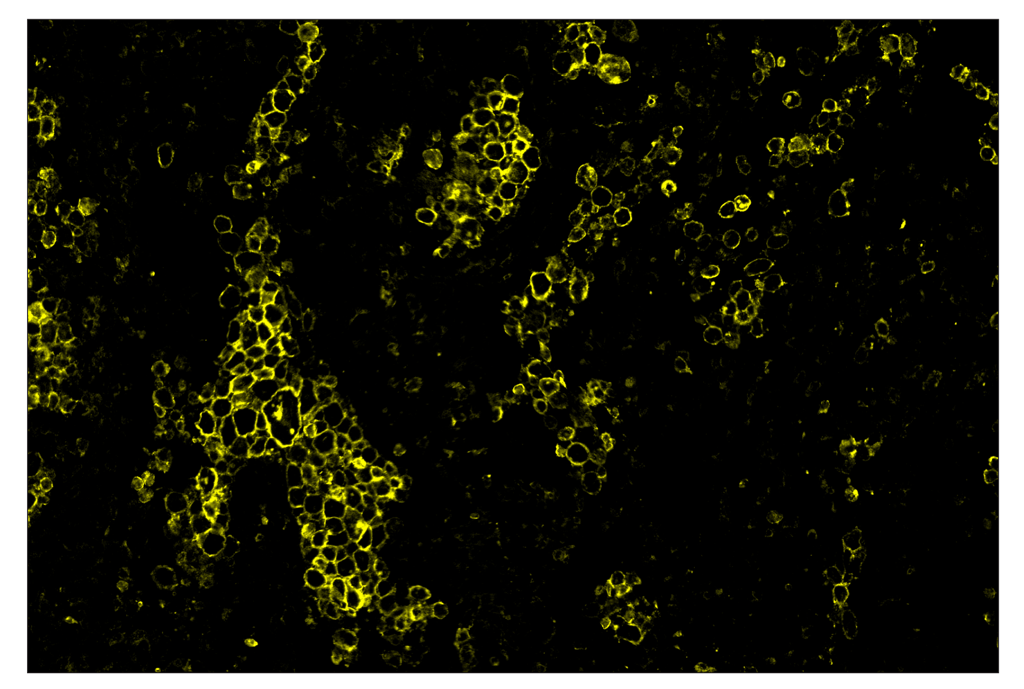 Immunohistochemistry Image 3: CD86 (E2G8P) & CO-0038-594 SignalStar™ Oligo-Antibody Pair