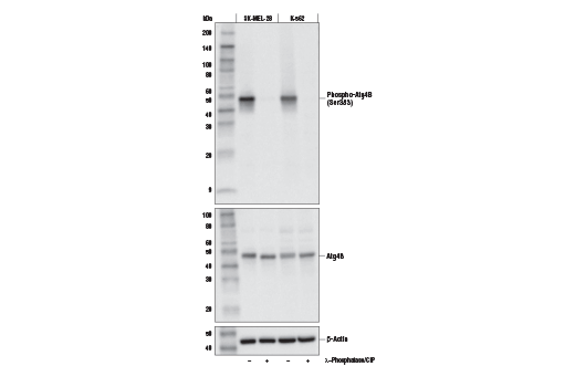 Western Blotting Image 1: Phospho-Atg4B (Ser383) Antibody