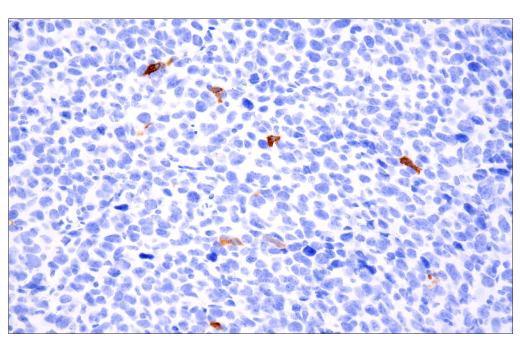 Immunohistochemistry Image 8: Tryptase (E7M2U) Rabbit mAb