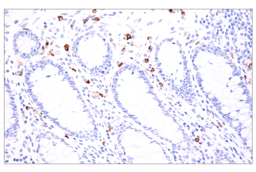 Immunohistochemistry Image 6: Tryptase (E7M2U) Rabbit mAb