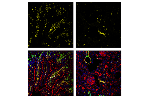 Immunofluorescence Image 1: CD45 (D3F8Q) Rabbit mAb (Alexa Fluor® 555 Conjugate)