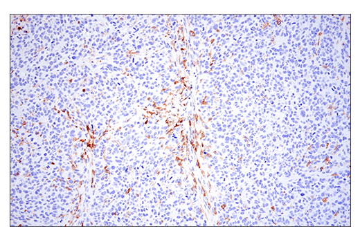 Immunohistochemistry Image 4: CD86 (E5W6H) Rabbit mAb