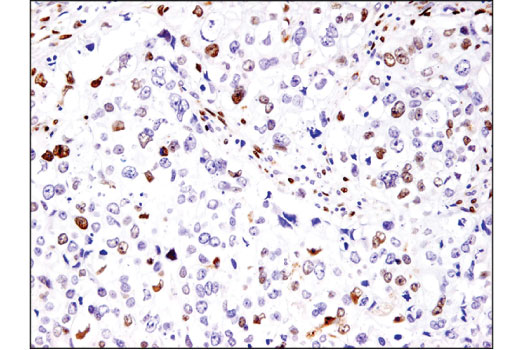 Immunohistochemistry Image 1: Fra2 (D2F1E) Rabbit mAb