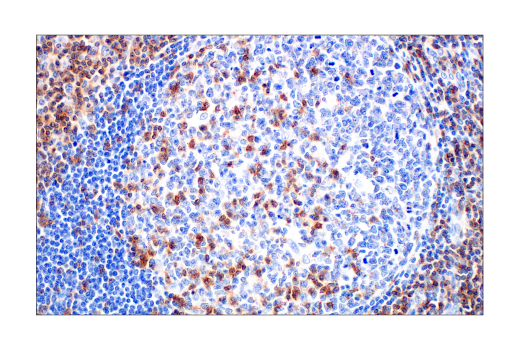 Immunohistochemistry Image 3: CD2 (D6V9F) Rabbit mAb (BSA and Azide Free)