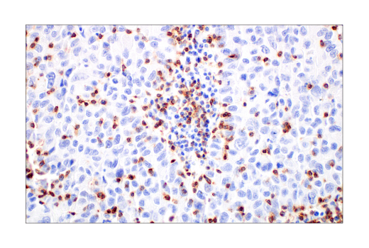 Immunohistochemistry Image 7: CD2 (D6V9F) Rabbit mAb (BSA and Azide Free)