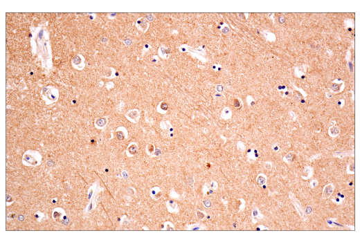 Immunohistochemistry Image 5: Phospho-Tau (Thr205) (E3E3B) Mouse mAb