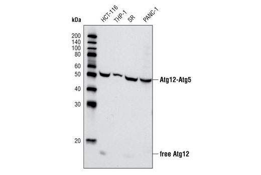 Western Blotting Image 1: Atg12 Antibody (Human Specific)