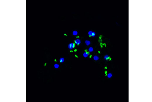Immunofluorescence Image 2: AE1/SLC4A1 (D3X1R) Rabbit mAb (IF Formulated)