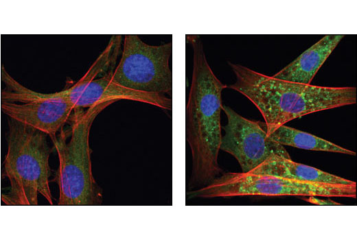 Immunofluorescence Image 1: Atg12 Antibody (Mouse Specific)