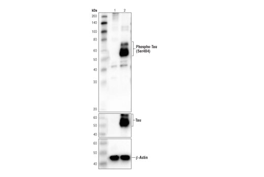  Image 27: LRP1-mediated Endocytosis and Transmission of Tau Antibody Sampler Kit