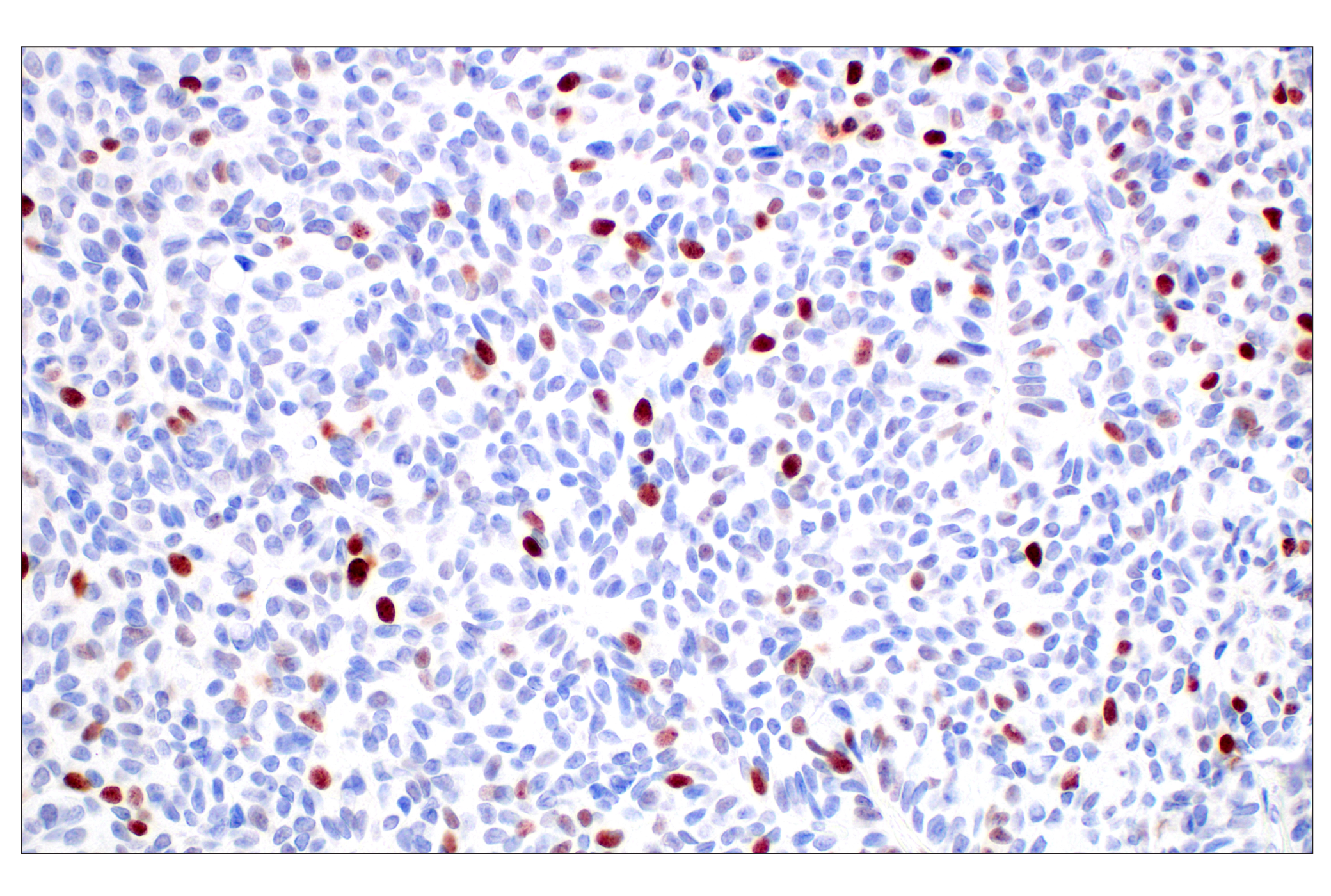 Immunohistochemistry Image 1: BRCA1 (E5S9G) Rabbit mAb (BSA and Azide Free)