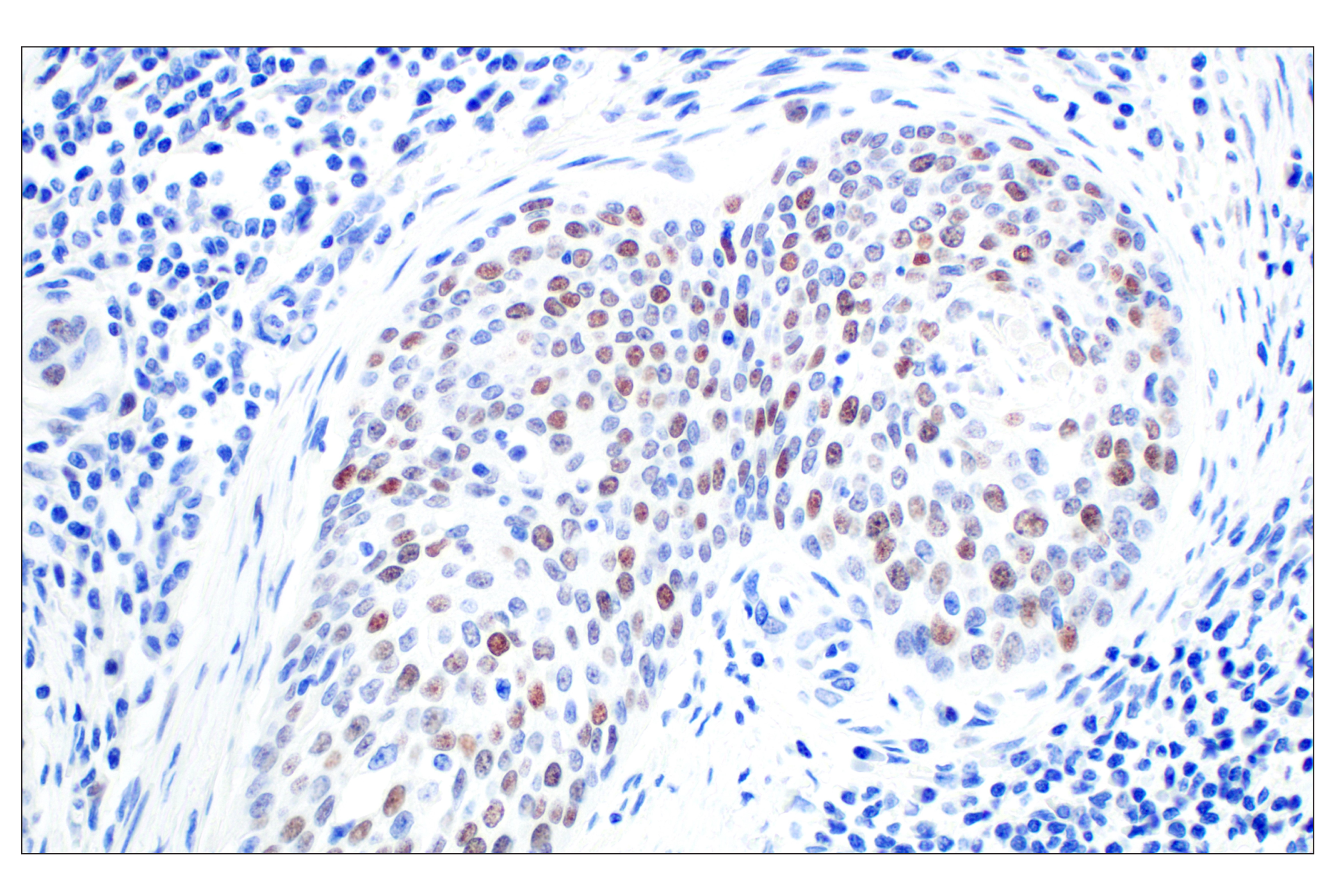 Immunohistochemistry Image 3: BRCA1 (E5S9G) Rabbit mAb (BSA and Azide Free)