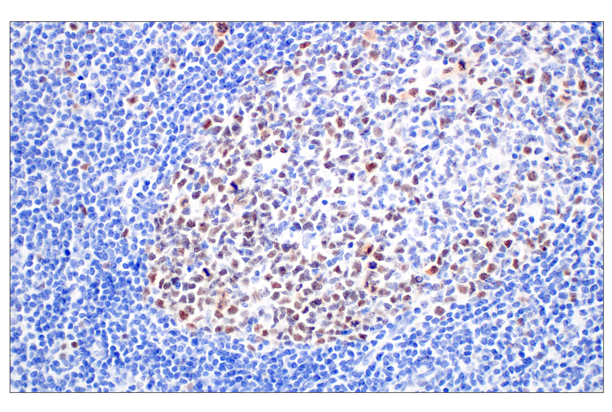 Immunohistochemistry Image 10: BRCA1 (E5S9G) Rabbit mAb (BSA and Azide Free)