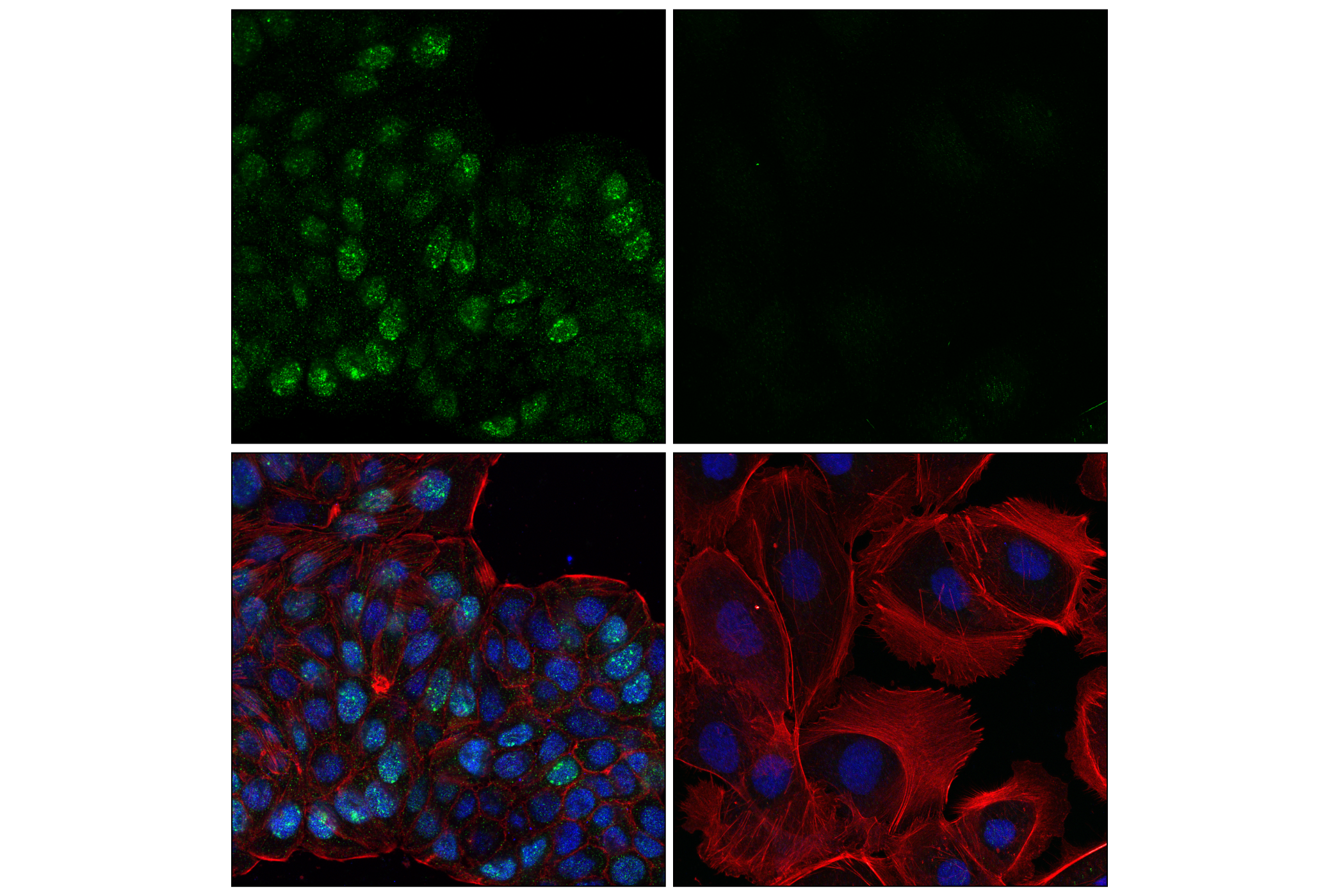 Immunofluorescence Image 1: BRCA1 (E5S9G) Rabbit mAb (BSA and Azide Free)