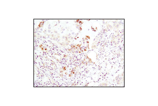  Image 13: Glycolysis Antibody Sampler Kit