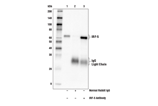Immunoprecipitation Image 1: IRF-5 Antibody