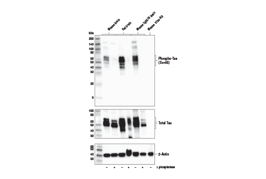 Western Blotting Image 1: Phospho-Tau (Ser46) Antibody
