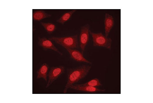Immunofluorescence Image 1: PP2A A Subunit Antibody