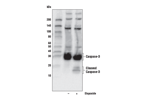  Image 3: Jurkat Apoptosis Cell Extracts (etoposide)