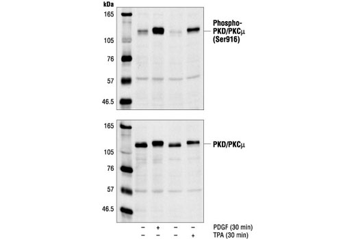 Western Blotting Image 1: Phospho-PKD/PKCμ (Ser916) Antibody