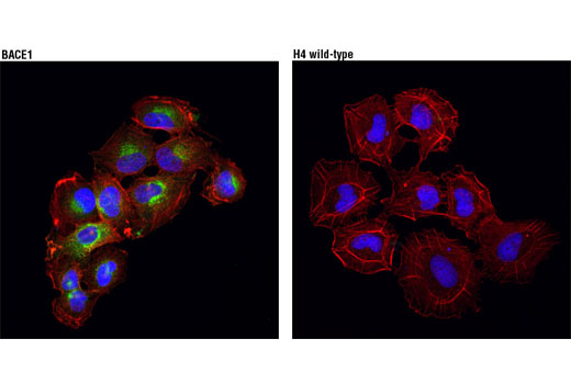Immunofluorescence Image 2: BACE (D10E5) Rabbit mAb (BSA and Azide Free)
