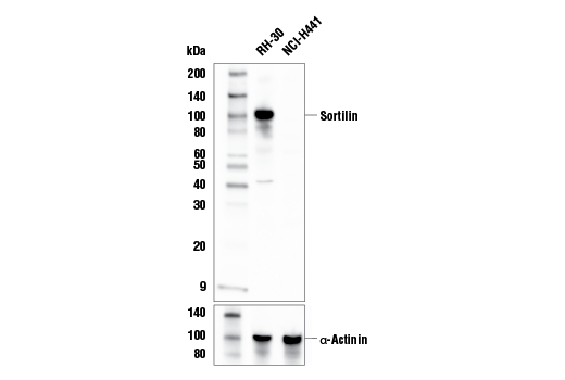Western Blotting Image 2: Sortilin Antibody