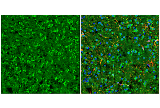 Immunofluorescence Image 2: ApoE (E7X2A) Rabbit mAb (BSA and Azide Free)