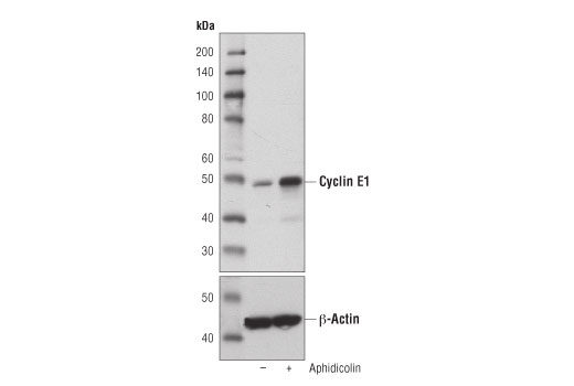  Image 13: Cell Cycle Phase Determination Antibody Sampler Kit