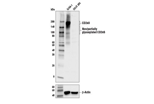 Western Blotting Image 1: CD248 Antibody