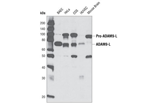 Western Blotting Image 1: ADAM9 Antibody