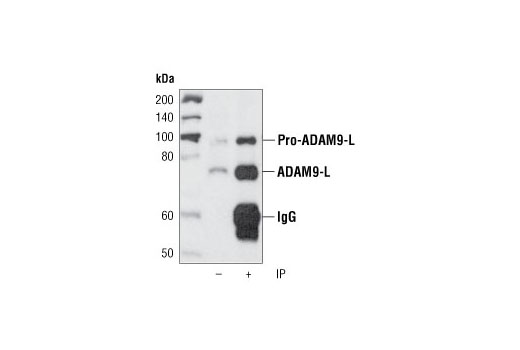 Immunoprecipitation Image 1: ADAM9 Antibody