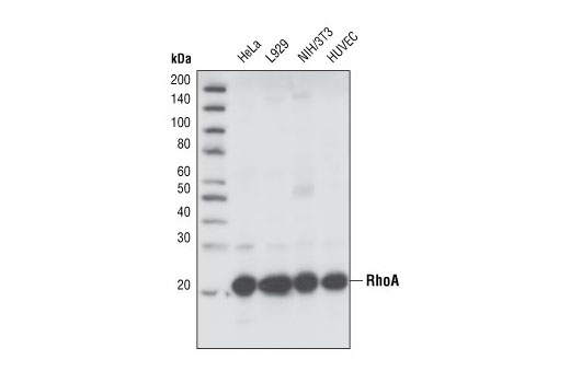  Image 2: Rho-GTPase Antibody Sampler Kit