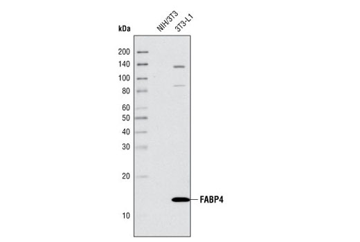 Image 1: Adipogenesis Marker Antibody Sampler Kit