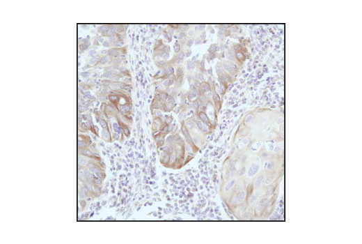  Image 19: Cytoskeletal Marker Antibody Sampler Kit