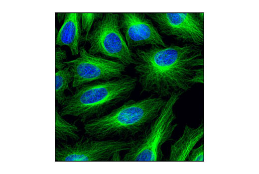 Beta Tubulin Antibody (9F3) | Cell Signaling Technology