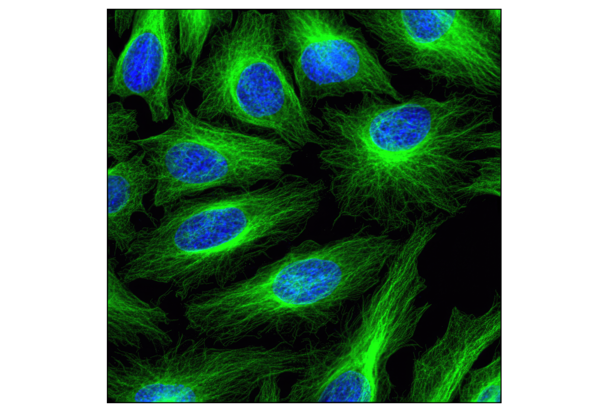  Image 35: Cytoskeletal Marker Antibody Sampler Kit