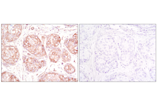 β-Tubulin Antibody | Cell Signaling Technology