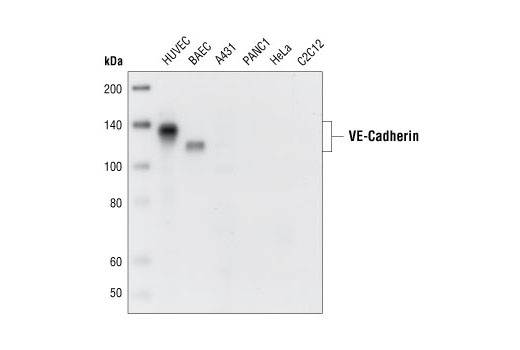 Western Blotting Image 1: VE-Cadherin Antibody