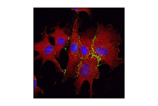 Immunofluorescence Image 1: VE-Cadherin Antibody