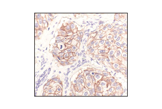 Immunohistochemistry Image 1: HER2/ErbB2 (29D8) Rabbit mAb