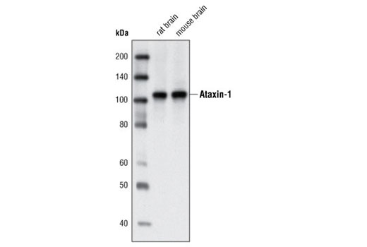 Western Blotting Image 1: Ataxin-1 Antibody