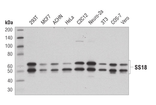  Image 6: BAF Complex IHC Antibody Sampler Kit